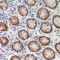 SMAD2 Rabbit Polyclonal Antibody