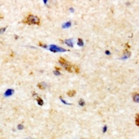 Anti-NKTR Antibody