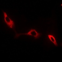 Anti-NKTR Antibody