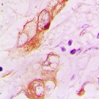 Anti-5-HT3A Antibody