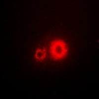 Anti-5-HT3A Antibody