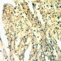 Anti-NAIP Antibody