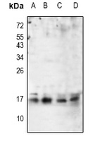 p16 ARC Rabbit Polyclonal Antibody