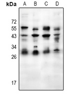 Placental lactogen Antibody