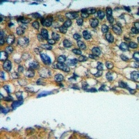 Anti-Placental lactogen Antibody