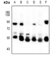 Cytokeratin-5/6 Antibody