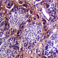 Anti-Cytokeratin-5/6 Antibody