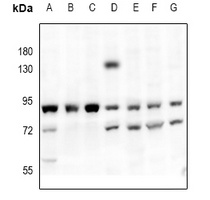 PKC-pan Antibody