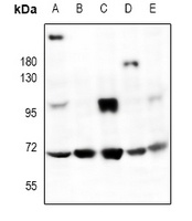 HMB45 Antibody