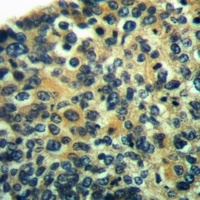 Anti-HMB45 Antibody