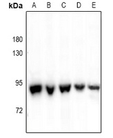 P5CS Rabbit Polyclonal Antibody
