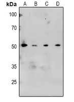 CaMK2 alpha/beta/delta (Phospho-T305) Antibody