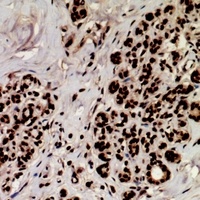 MEF2A (phospho-S408) antibody