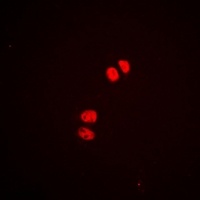 MEF2A (phospho-S408) antibody