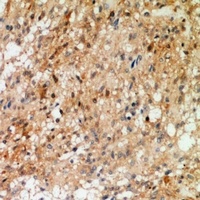 Synaptotagmin (Phospho-T202/199) Antibody