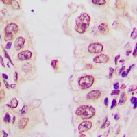 C/EBP alpha (Phospho-S21) Antibody