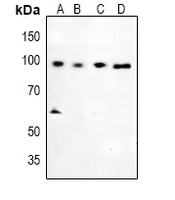 Glucocorticoid Receptor (Phospho-S226) Antibody