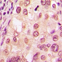 Glucocorticoid Receptor (Phospho-S226) Antibody