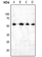 PTEN (Phospho-S385) Antibody