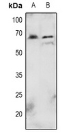 AKT (Phospho-T72) Antibody