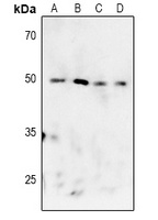 MK2 (Phospho-T222) Antibody
