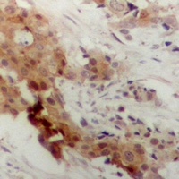 MK2 (Phospho-T222) Antibody
