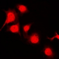 PTK6 (phospho-Y447) antibody