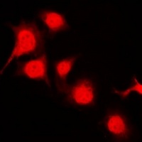 Anti-BRK (Phospho-Y447) Antibody