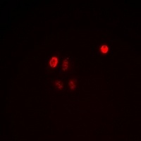 Anti-C/EBP epsilon (Phospho-T74) Antibody
