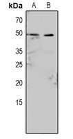 Caspase 9 (Phospho-Y153) Antibody