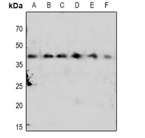 CDK7 (Phospho-T170) Antibody