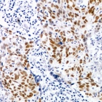 Anti-CDK7 (Phospho-T170) Antibody