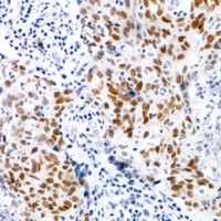 CDK7 (phospho-T170) antibody