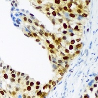 CDKN1C (phospho-T310) antibody