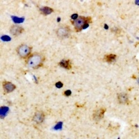 Anti-TPH1 (Phospho-S58) Antibody