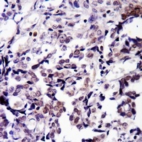 Anti-CDK9 (Phospho-T186) Antibody