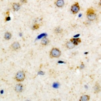 Anti-IGFBP3 (Phospho-S183) Antibody