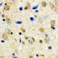 Anti-Kir6.2 (Phospho-T224) Antibody