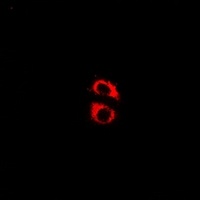 Anti-Kir6.2 (Phospho-T224) Antibody