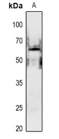 PAK1 (Phospho-S199) Antibody