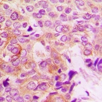 PAK1 (Phospho-S199) Antibody