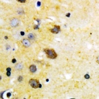 Anti-MKK4 (Phospho-S257) Antibody