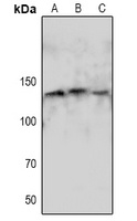 eNOS (Phospho-S1179) Antibody