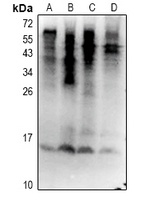 Ubiquitin (Phospho-S65) Antibody