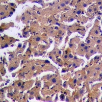 Anti-PINK1 (Phospho-S228) Antibody