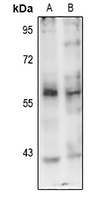 PINK1 (Phospho-S402) Antibody