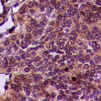 PINK1 (Phospho-S402) Antibody