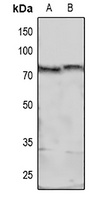 MARCKS (Phospho-S158) Antibody