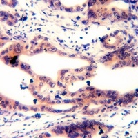 Anti-MARCKS (Phospho-S158) Antibody