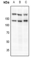 c-Met (Phospho-S985) Antibody